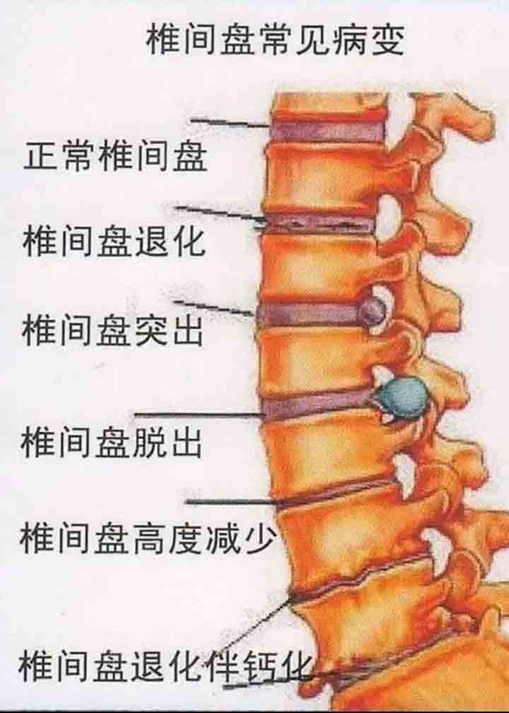脊椎图002.jpg